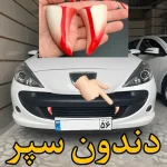 دندون سپر